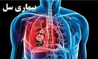 آزمایش سل در خانه های بهداشت و مراکز خدمات جامع سلامت روستایی و شهری به صورت رایگان انجام میشود