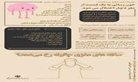 شایع ترین علل و علائم بروز سکته مغزی را بیشتر بشناسیم