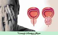 دومین سرطان شایع در مردان 